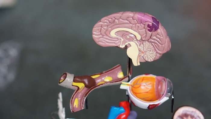 Anatomical model of the human brain